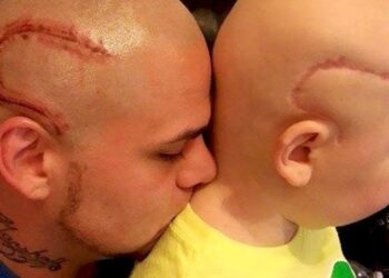 Dad with similar scar to son (Facebook | Josh J-Mash Marshall)