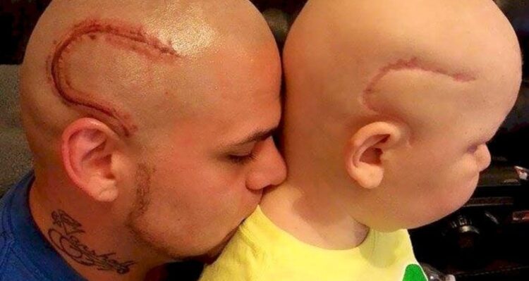 Dad with similar scar to son (Facebook | Josh J-Mash Marshall)