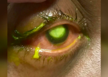 Facebook | Vita Eye Clinic