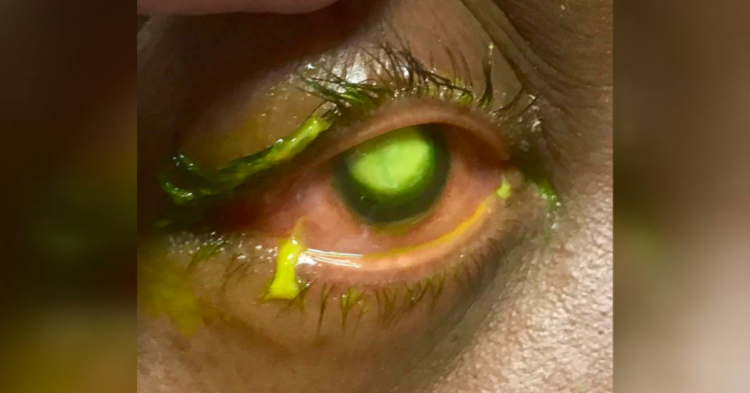 Facebook | Vita Eye Clinic