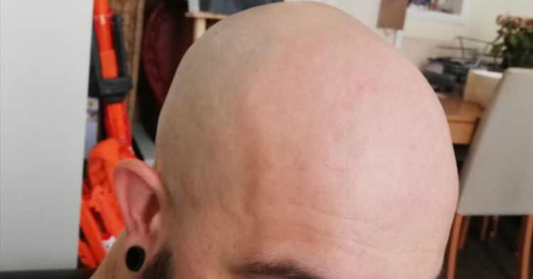 Reddit | Arkaboop