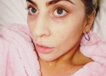 Instagram | @ladygaga