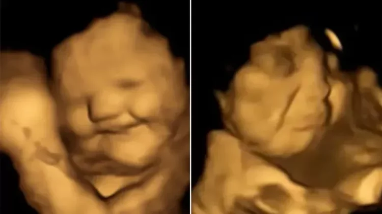 People  | Durham University Fetal and Neonatal Research Lab