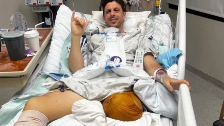 Go Fund Me | Dave Miln/ Gofundme