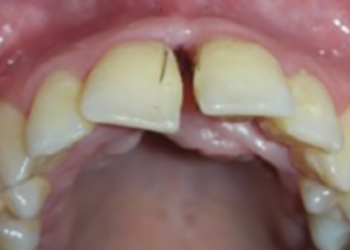 Oral Surgery