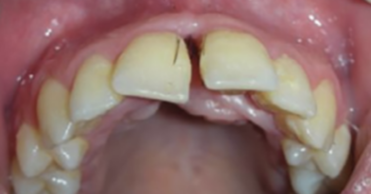 Oral Surgery