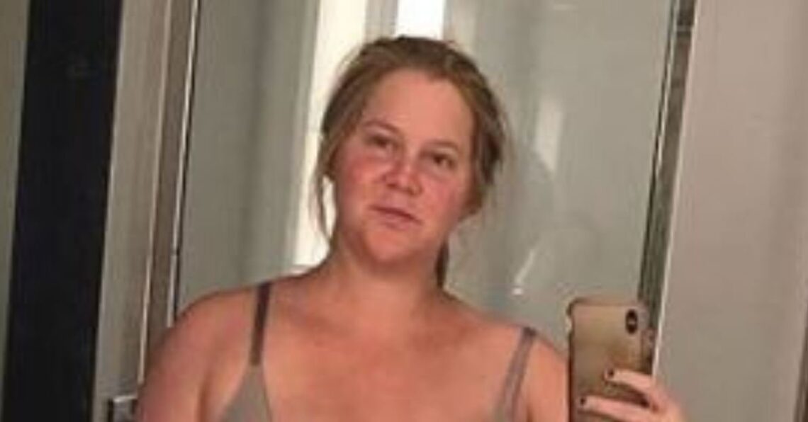 Instagram | @amyschumer