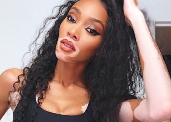 Instagram | @winnieharlow