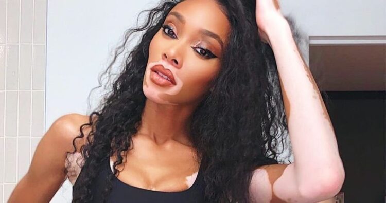 Instagram | @winnieharlow