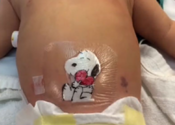 Facebook | Akron Children’s Hospital