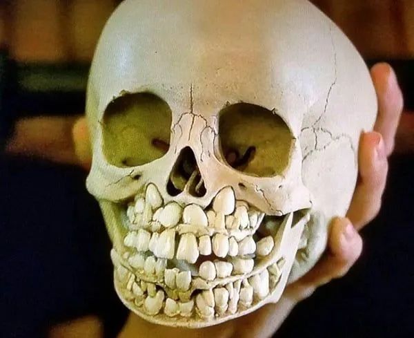 baby skull