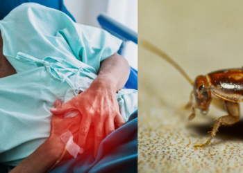 split screen of man with indigestion and picture of a cockroach