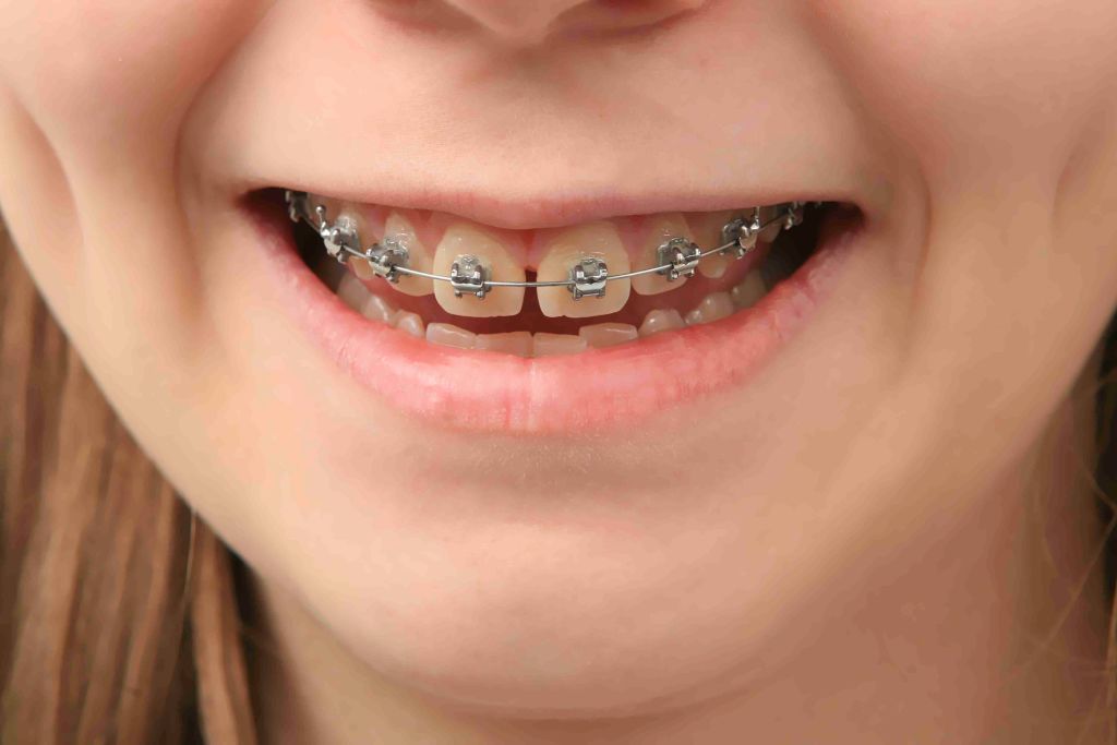 Orthodontics.