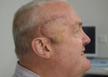 Paul is the first patient recruited for a new brain cancer trial