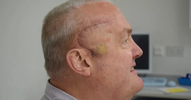 Paul is the first patient recruited for a new brain cancer trial