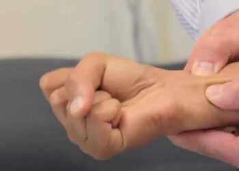 This test is used to check the overall blood supply to the hand