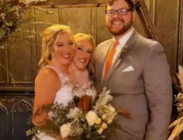 Abby and Brittany Hensel with husband