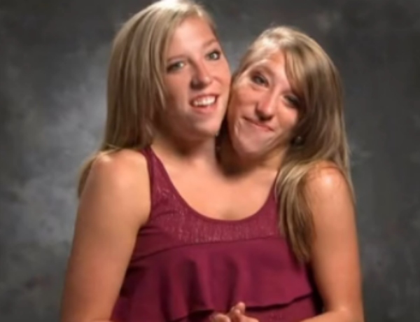 Abby and Brittany Hensel