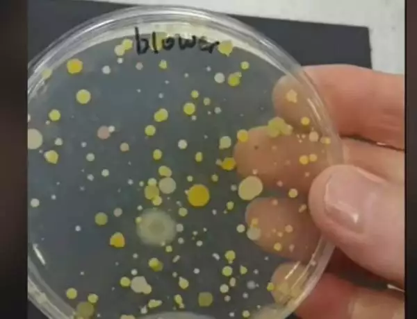 Agar plate with bacteria