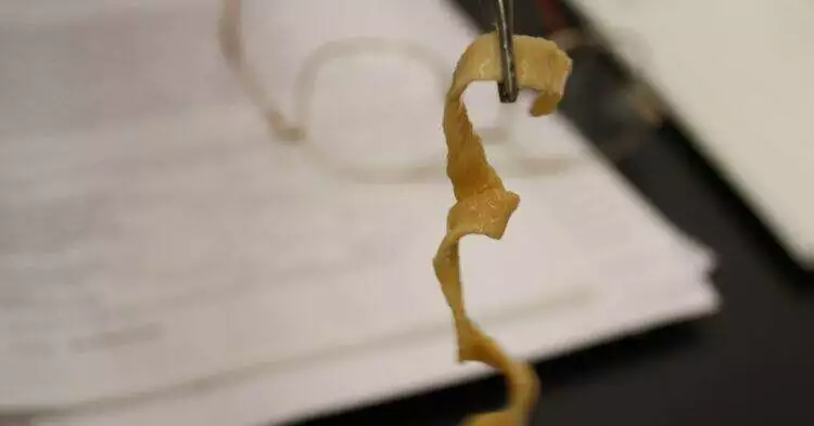 X-ray reveals cysts of tapeworm larvae in a patient