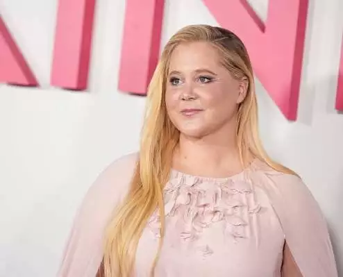 Amy Schumer, moon face, Cushing's syndrome