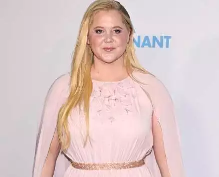 Amy Schumer, moon face, Cushing's syndrome