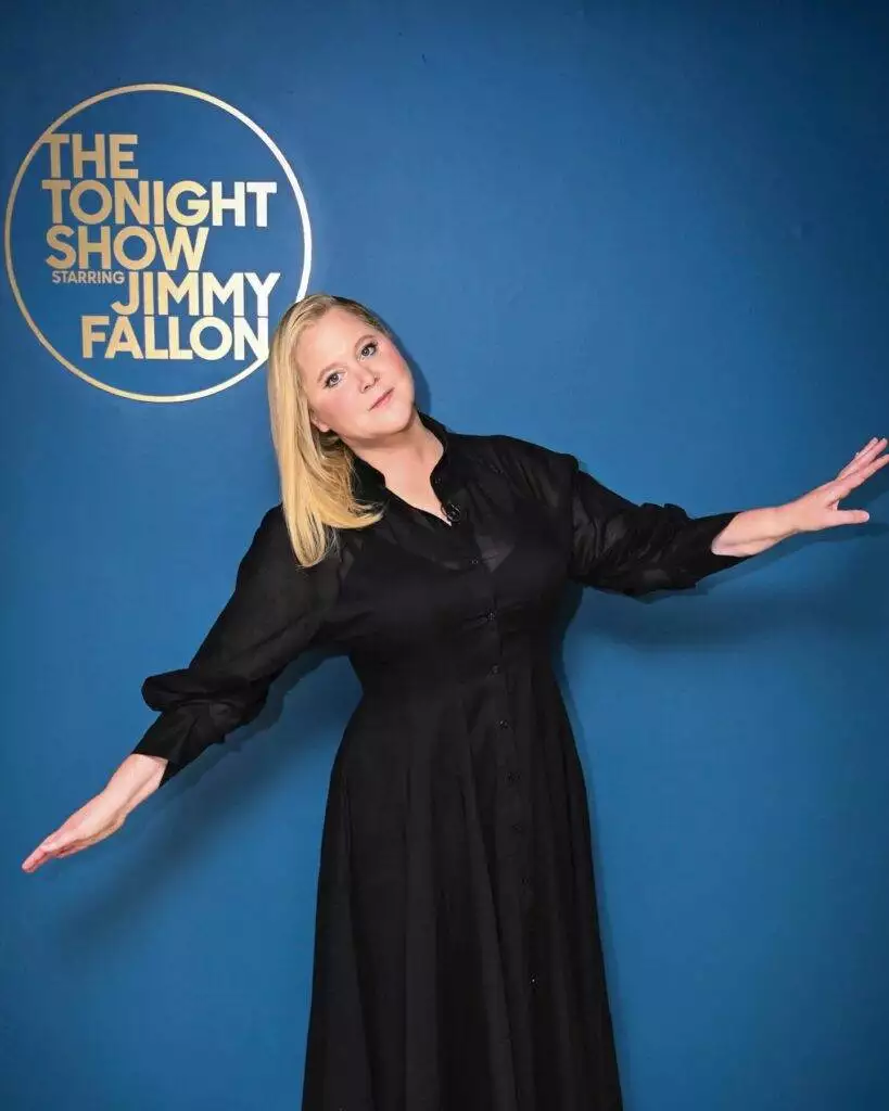 Amy Schumer, moon face, Cushing's syndrome