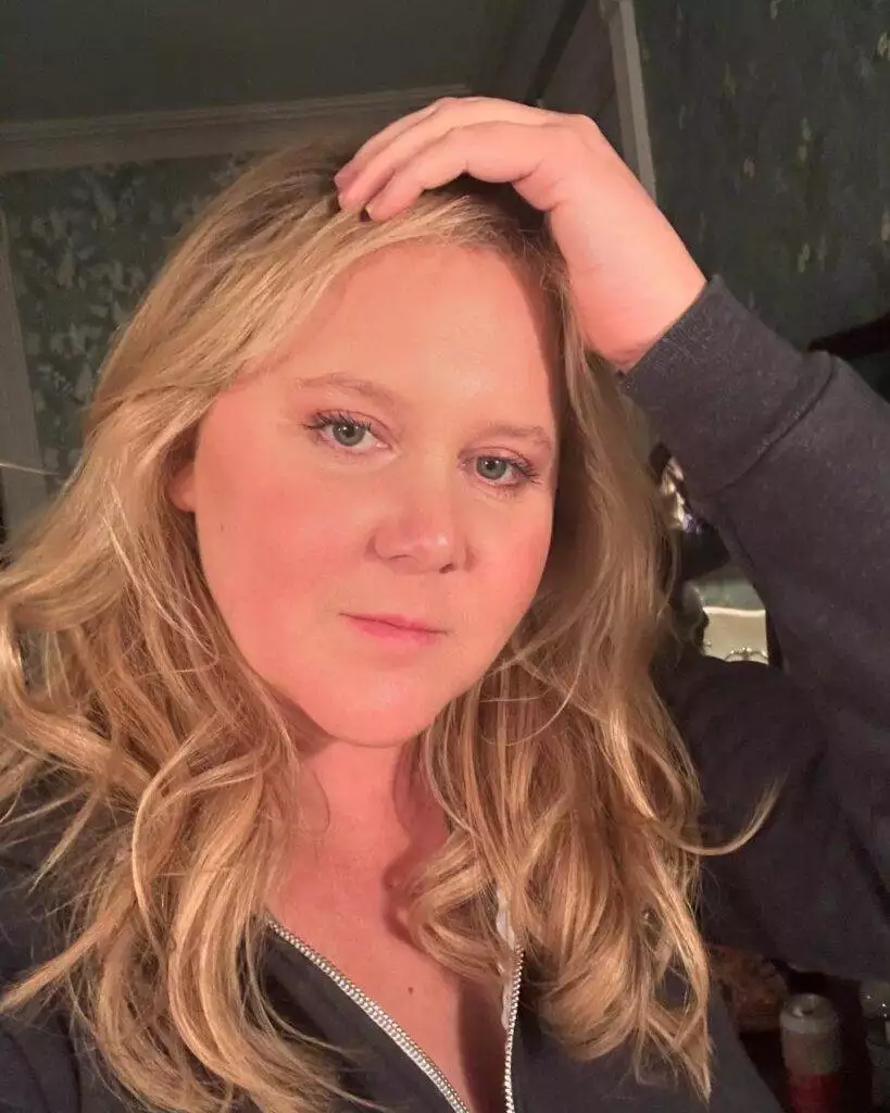 Amy Schumer, moon face, Cushing's syndrome