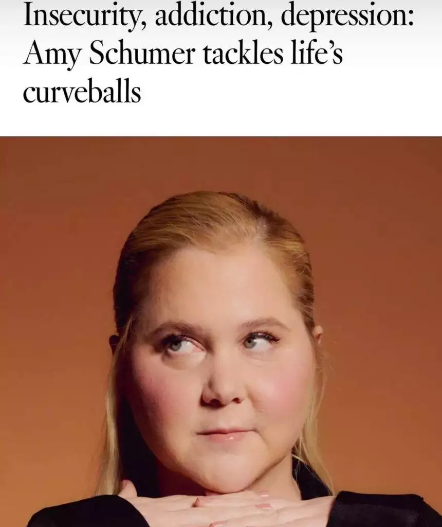 Amy Schumer, moon face, Cushing's syndrome