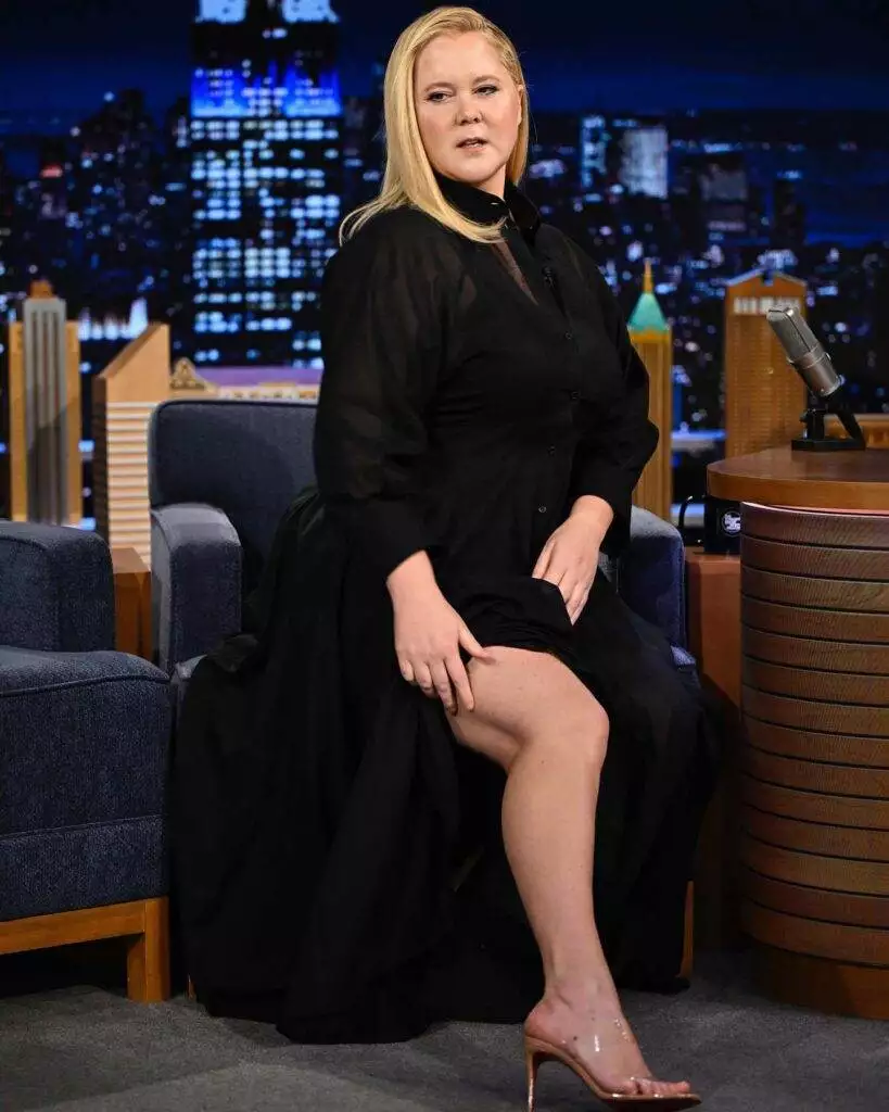 Amy Schumer, moon face, Cushing's syndrome