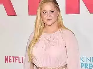 Amy Schumer, moon face, Cushing's syndrome