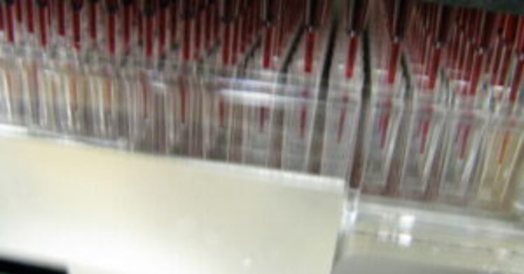 Popular DNA testing site sparks privacy concerns
