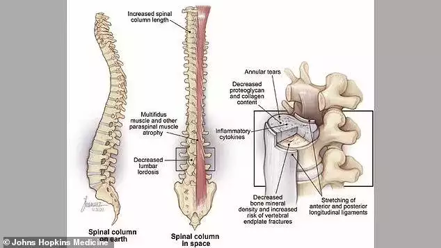 NASA Astronauts May Face a Mysterious Health Problem for the Rest of Their Lives!