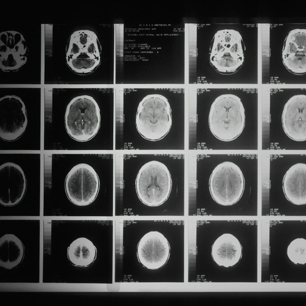a black and white photo of various mri images