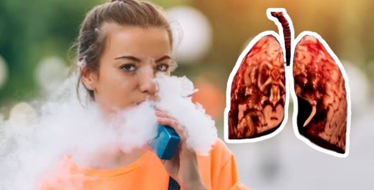 Vaping