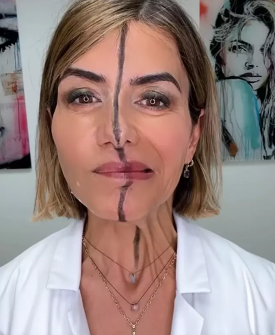 Dr Bita Farrell injected right side of her face