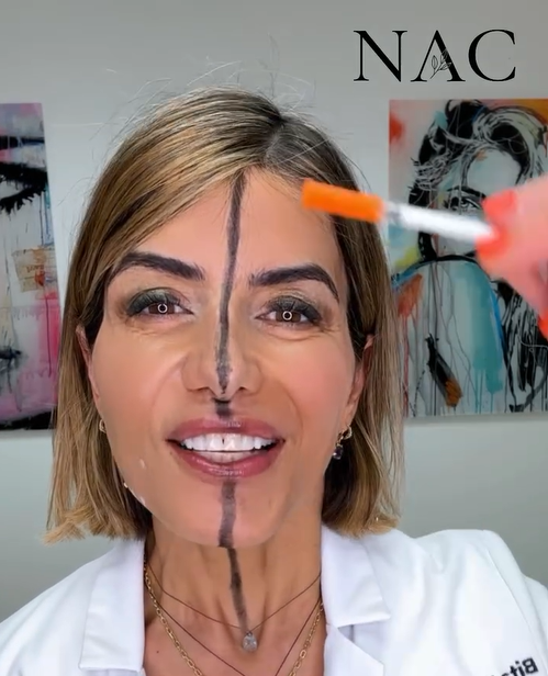 Dr Bita Farrell injected right side of her face