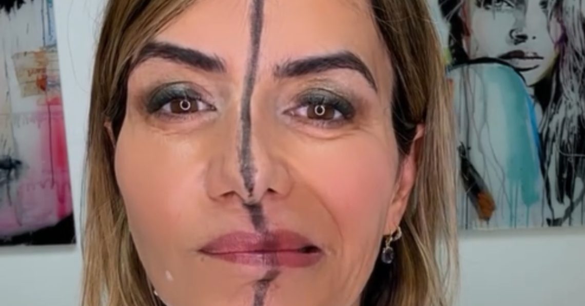 Dr Bita Farrell injected right side of her face