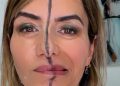Dr Bita Farrell injected right side of her face