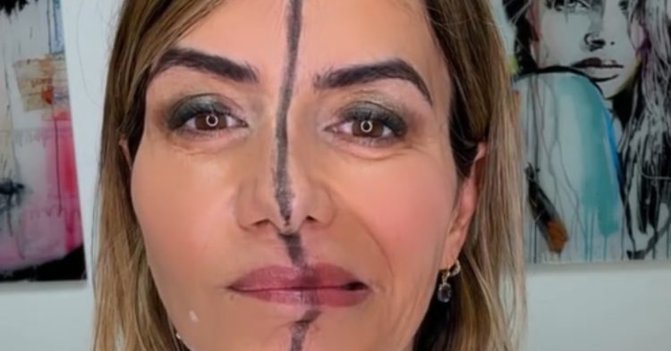 Dr Bita Farrell injected right side of her face