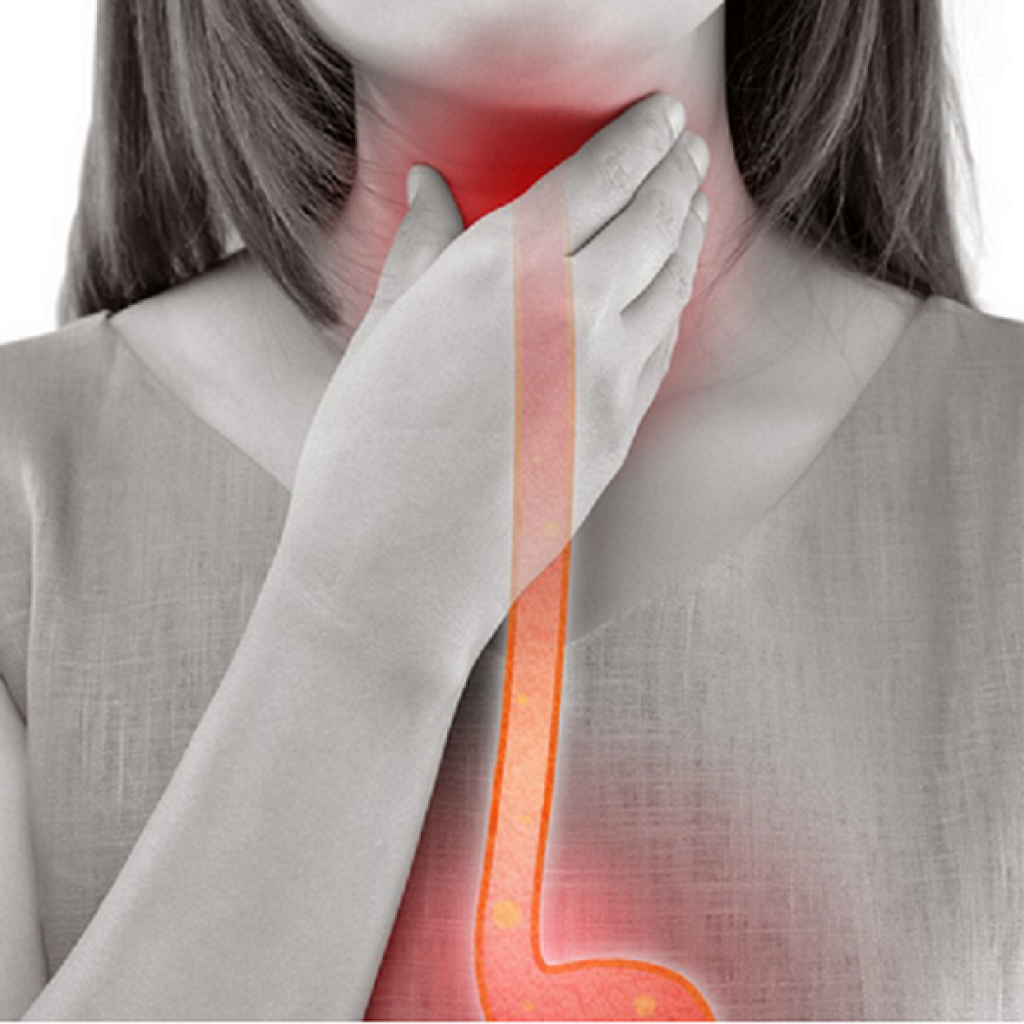 achalasia, achalasia causes, achalasia symptoms, achalasia diagnosis, sore throat, esophagus, sore throat, sore throat, sore throat, sore throat, sore throat, esophagus