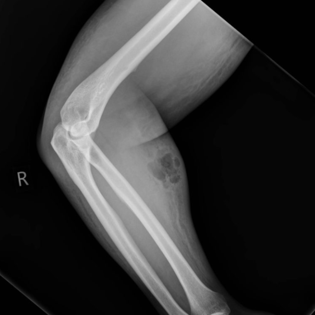 X-ray